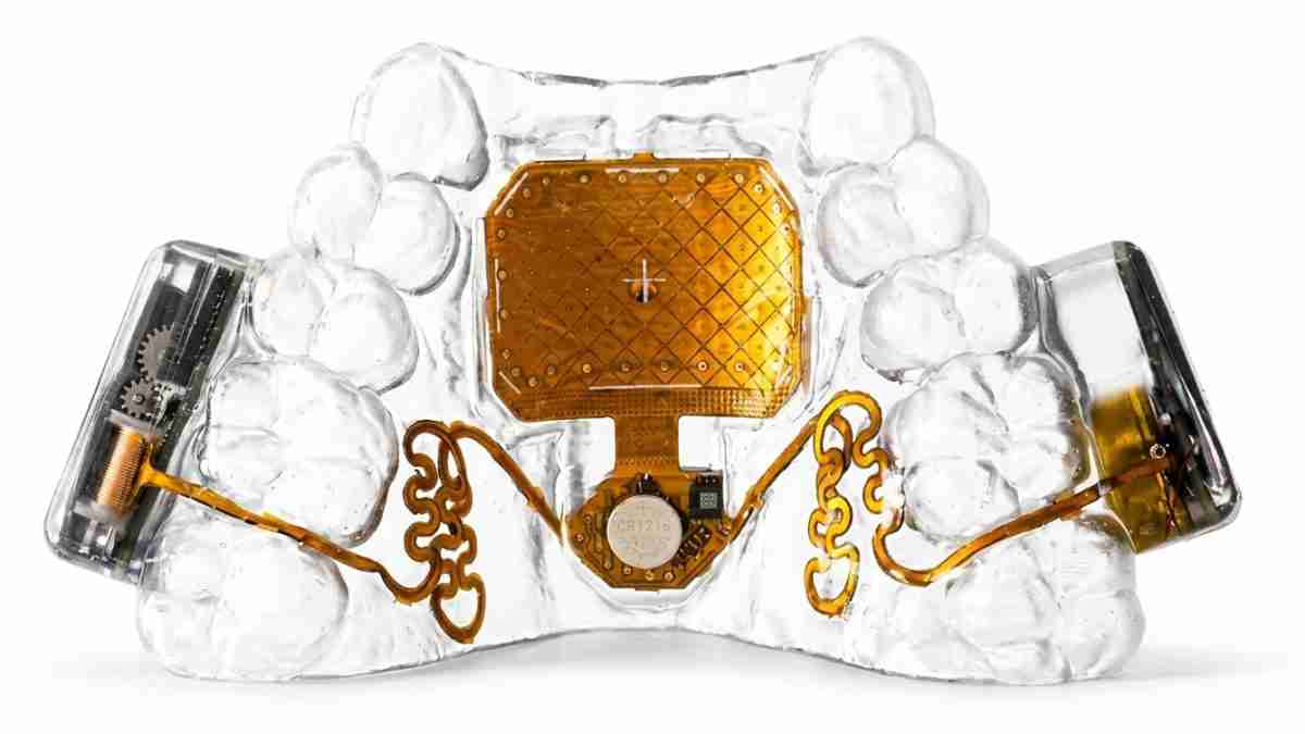 Clear jaw model with a gold dental implant prototype and embedded electronics in the center