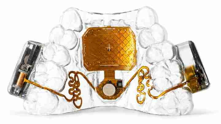 Clear jaw model with a gold dental implant prototype and embedded electronics in the center